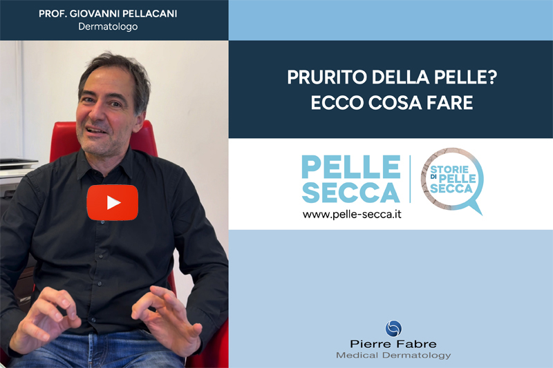 Prurito della pelle, ecco cosa fare